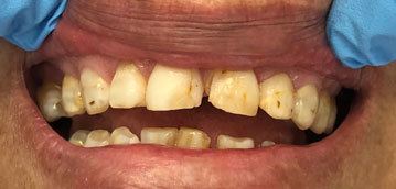 Before Dental Treatment 1