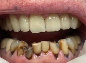 Before Dental Treatment photo